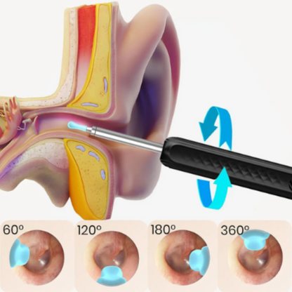 EarCam® Limpiador de oídos con cámara