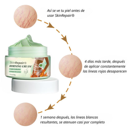 SKINREPAIR® CREMA CALIENTE REPARADORA